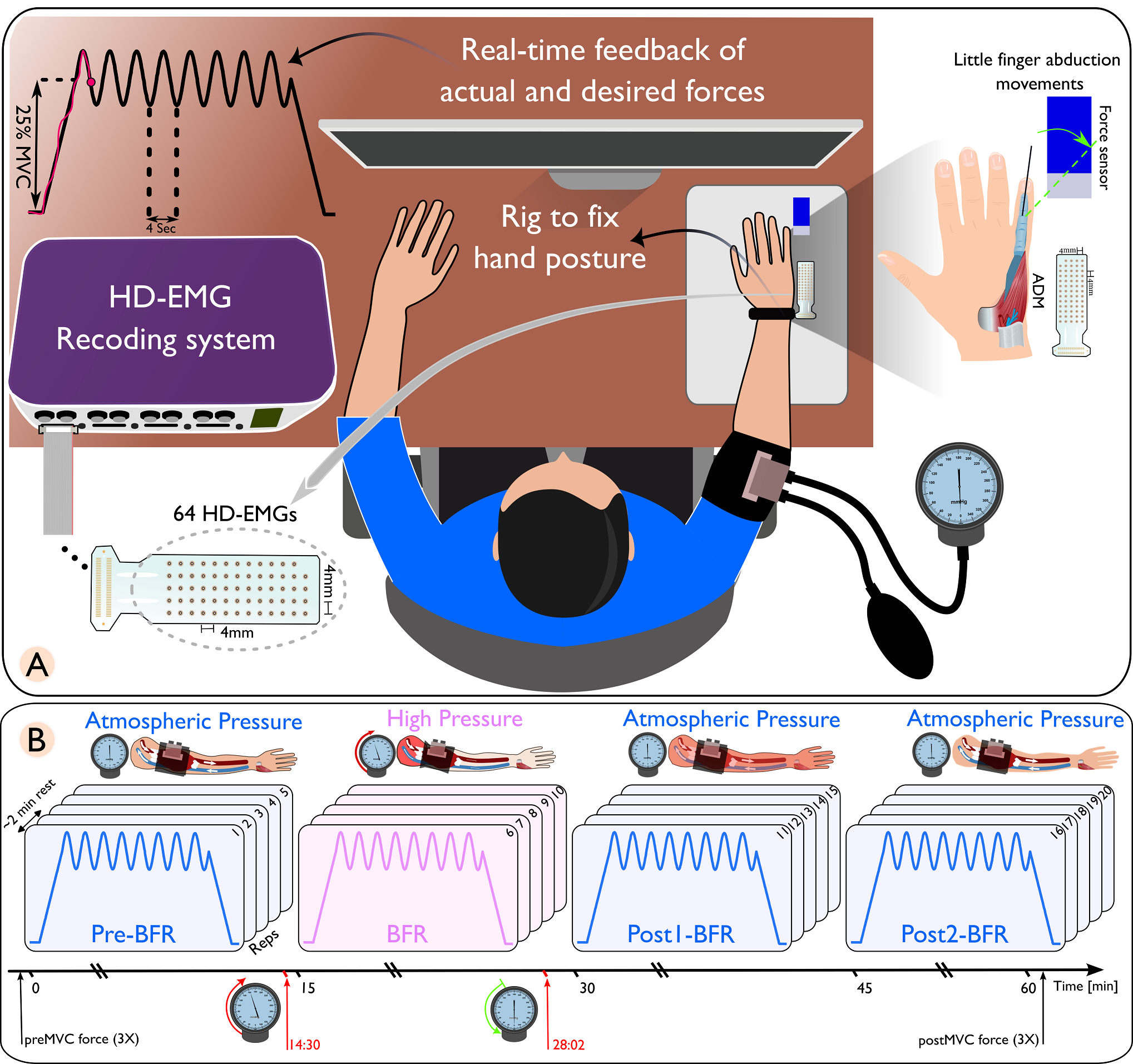 Experimental setup showing HD-EMG recording during blood flow restriction